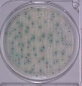 Abb. zeigt V. parahaemolyticus ATCC 17802 auf Compact Dry VP