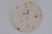 Abb. zeigt  E. coli (blau-violett), Citrobacter freundii (rot), Salm. enteritidis (farblos)