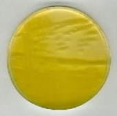 Abb. zeigt Pseudomonas fluorescens, zeigt eine gelb-grne Frbung im Tageslicht und fluoresziert im UV-Licht (366nm)