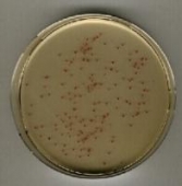 Abb. zeigt rote Enterokokken-Kolonien auf Merck Chromocult Enterococcus-Selektivagar (aus Merck-Manual)